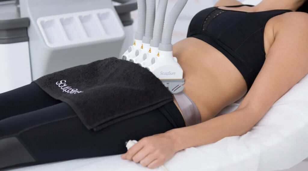 tucson woman receiving sculpsure treatment on lower stomach