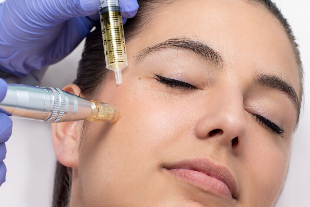 tucson woman receives eclipse micropen microneedling treatment