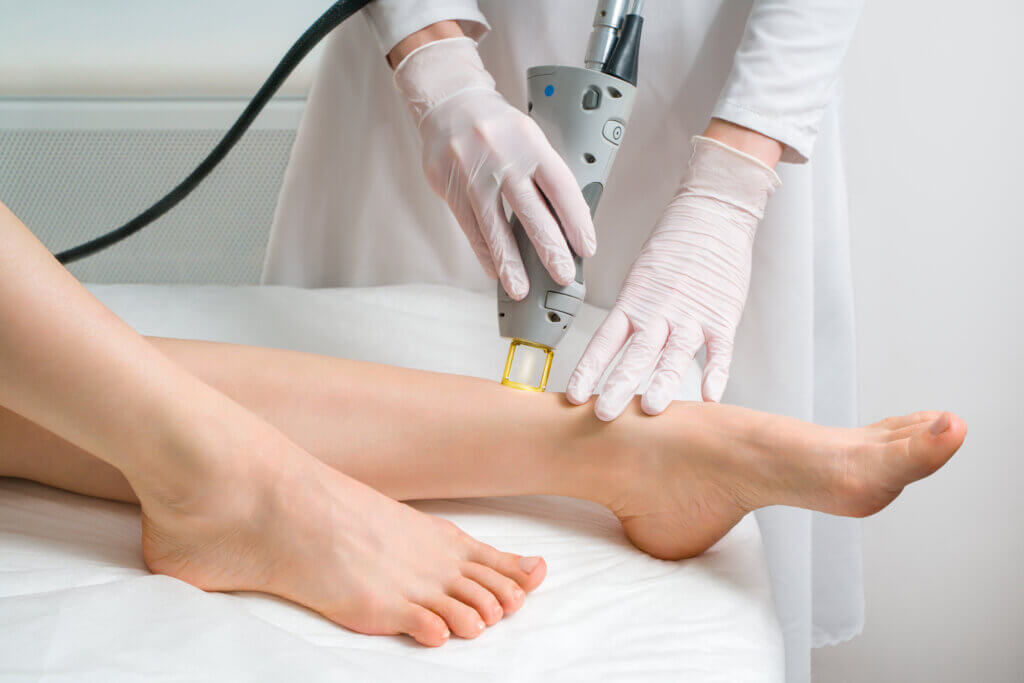 tucson woman receives laser skin treatment on leg
